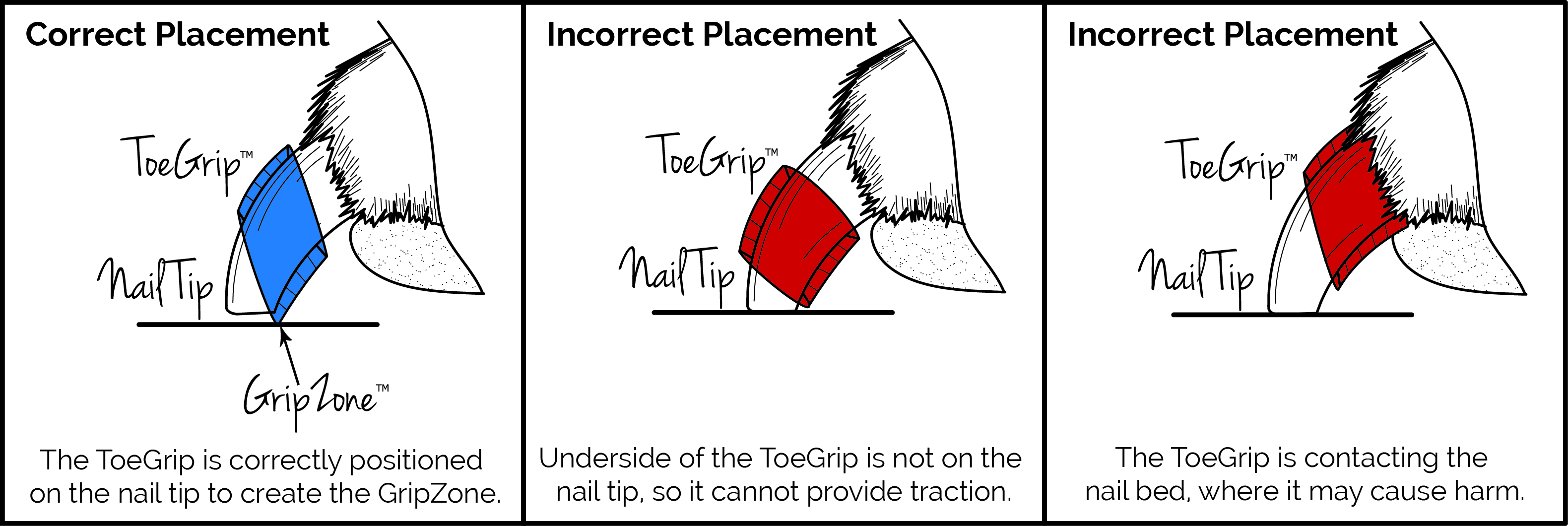 ToeGrips Placement